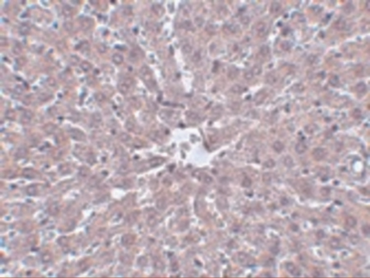 Immunohistochemistry of IRAK in rat liver tissue with IRAK antibody at 5 ug/mL.