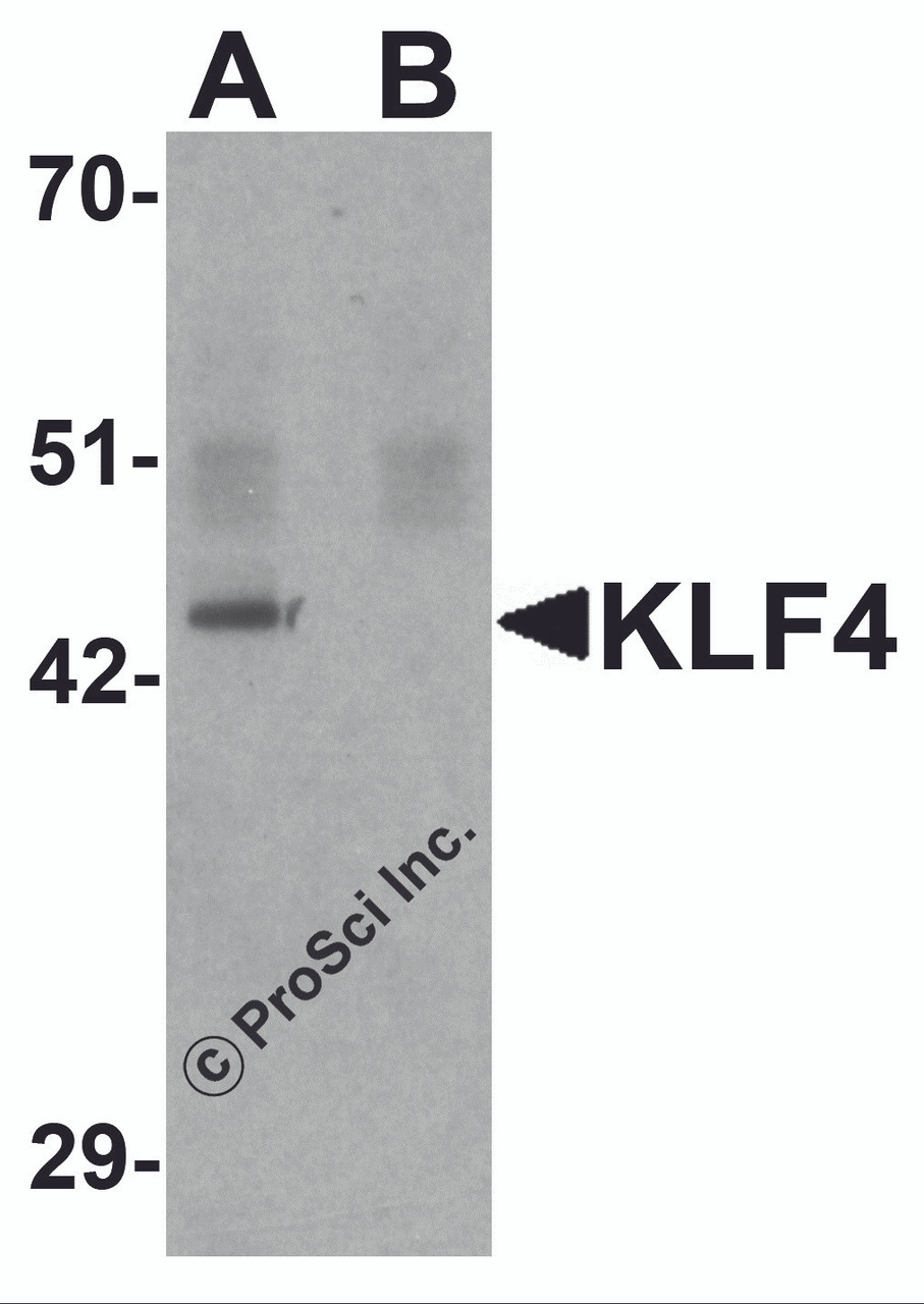 Western blot analysis of KLF4 in mouse liver tissue lysate with KLF4 antibody at 1 &#956;g/mL in (A) the absence and (B) the presence of blocking peptide.