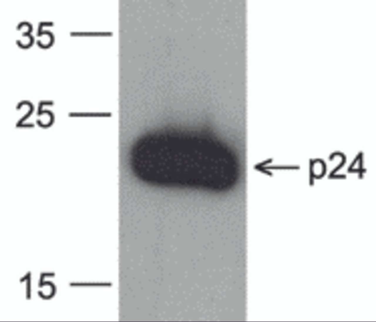Western blot analysis of 20 ng of recombinant HIV-1 p24 protein with PM-6335-biotin at 0.2 &#956;g/mL.