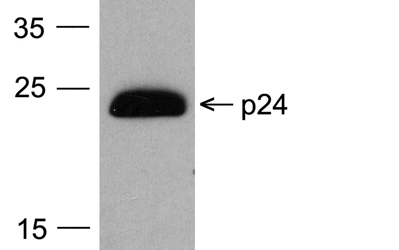 Western blot analysis of 20 ng of HIV-1 p24 protein with PM-6585-HRP at 0.2 &#956;g/mL.