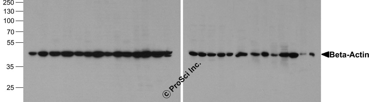 Western blot analysis of Beta-Actin in 293, A431, A549, Daudi, HeLa, HepG2, Jurkat, K562, MOLT, 3T3, Raji, Ramos, THP-1, U937, human brain, mouse brain, rat brain, rabbit brain, mouse lung, rat lung, rat liver, rabbit liver, rabbit spleen, chicken liver, chicken small intestine, zebrafish, and drosophila lysate with beta-Actin antibody at 1 &#956;g/mL.