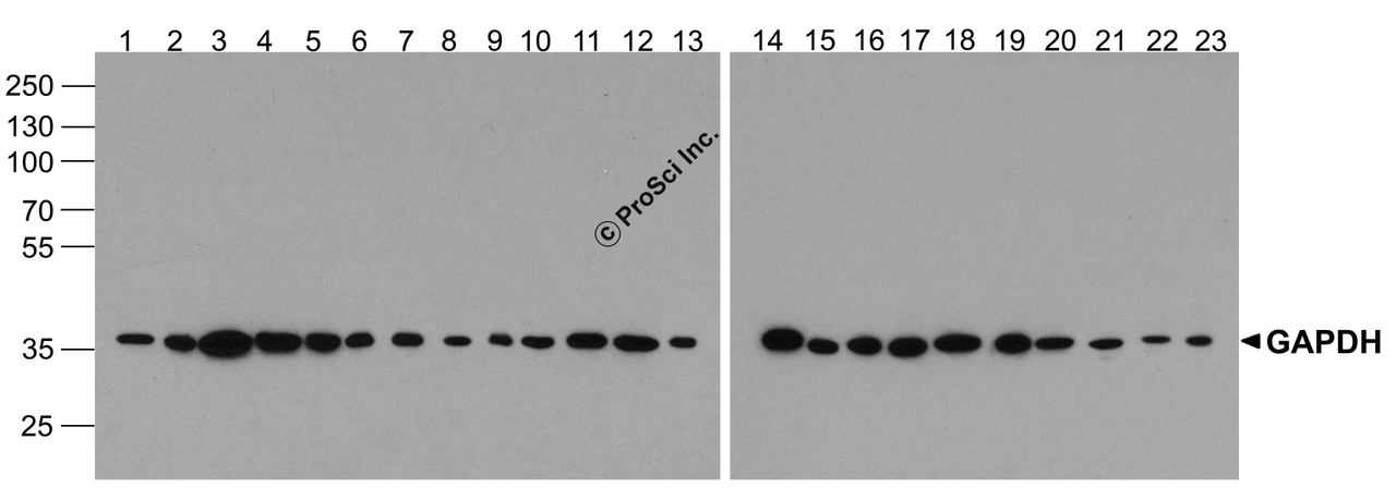 Western blot analysis of GAPDH in multiple cell and tissue lysates with GAPDH antibody at 1 &#956;g/ml. Lanes 1-23, 293, A431, A549, Daudi, HeLa, HepG2, Jurkat, K562, MOLT, 3T3, Raji, Ramos, U937, human brain, mouse brain, rat brain, rabbit brain, human heart, rat heart, human liver, mouse liver, rat liver, rabbit liver, respectively.