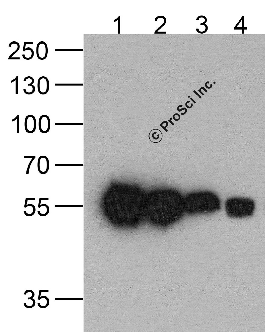 Western blot analysis of (1) 200ng, (2) 100 ng, (3) 50 ng, and (4) 25 ng of a HAT-tag-containing recombinant GGP1 protein with HAT-tag antibody at 0.5 &#956;g/ml.