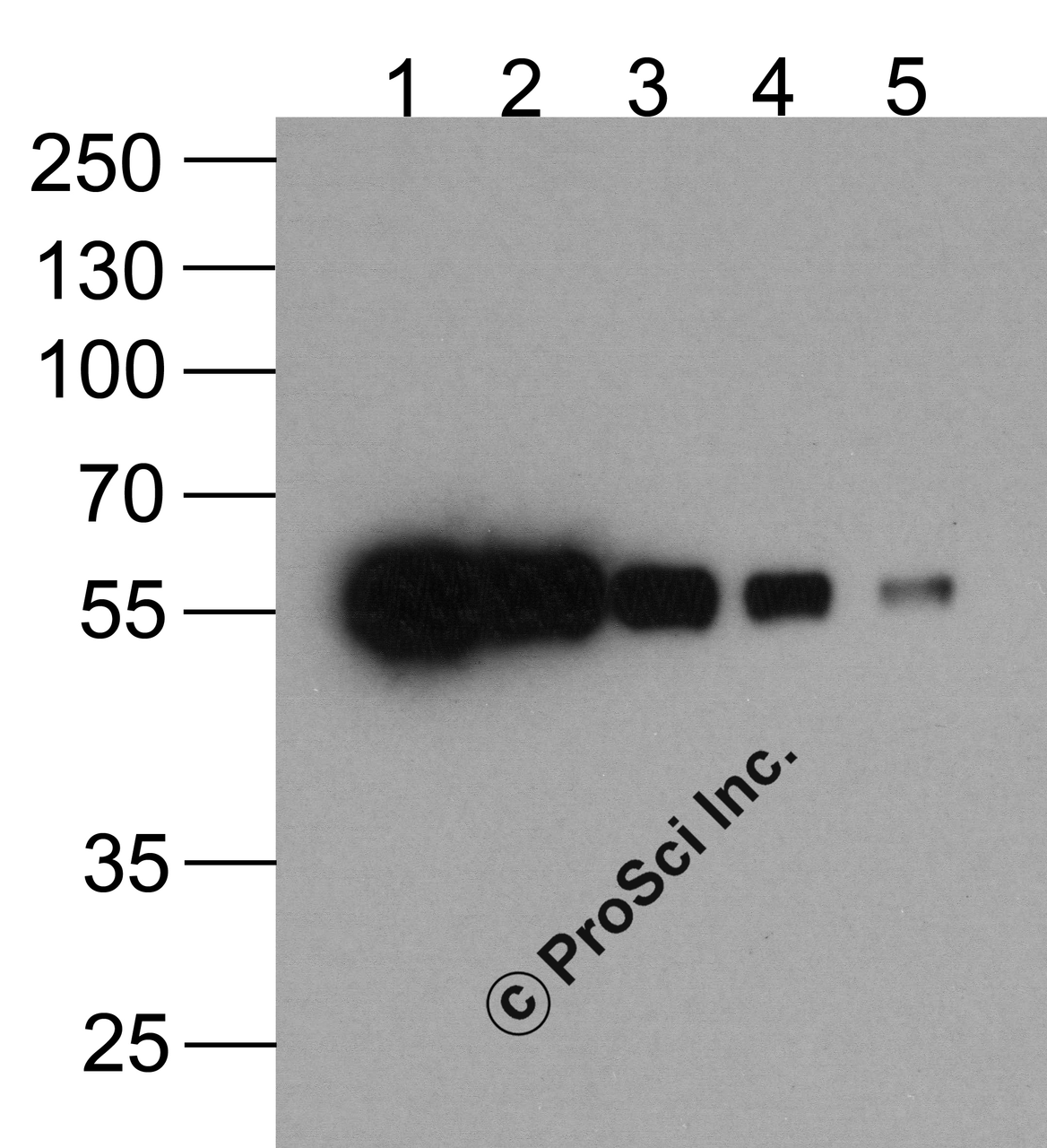 Western blot analysis (1) 200ng, (2) 100ng, (3) 50ng, (4) 25ng, and (5) 12.5ng of a HAT-tagged recombinant protein using biotinylated anti-HAT-tag monoclonal antibody at 0.5 &#956;g/ml.