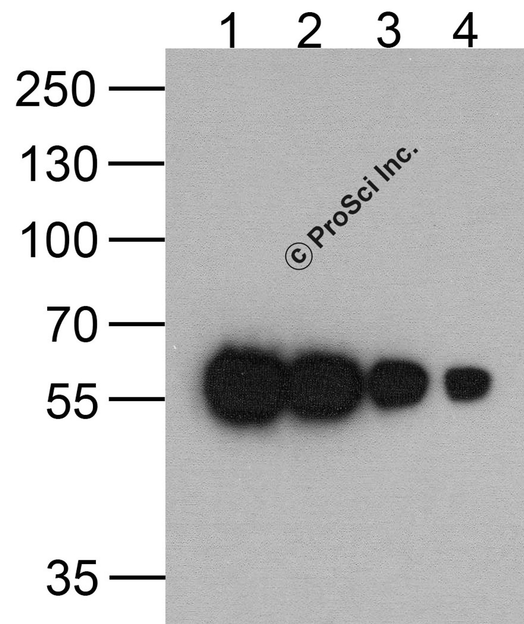 Western blot analysis of (1) 200ng, (2) 100 ng, (3) 50 ng, and (4) 25 ng of a HAT-tag-containing recombinant GGP1 protein with HAT-tag antibody at 0.5 &#956;g/ml.