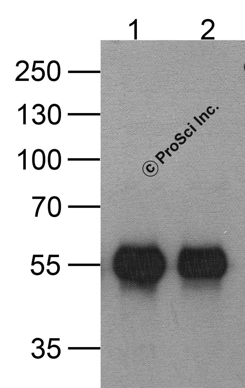 Western blot analysis of (1) 20 ng of HAT-tagged recombinant GGP1 protein and (2) 20 ng of HAT-tagged recombinant GGP1 protein using 1 ug of HAT-tag antibody to immunoprecipitate and 1 ug/ml anti-GGP1 antibody to detect.