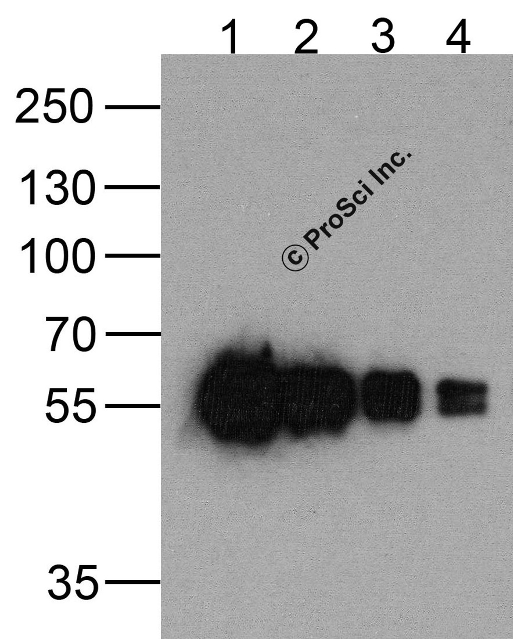 Western blot analysis of (1) 200ng, (2) 100 ng, (3) 50 ng, and (4) 25 ng of a cMyc-tag-containing recombinant GGP1 protein with cMyc-tag antibody at 0.5 &#956;g/ml.