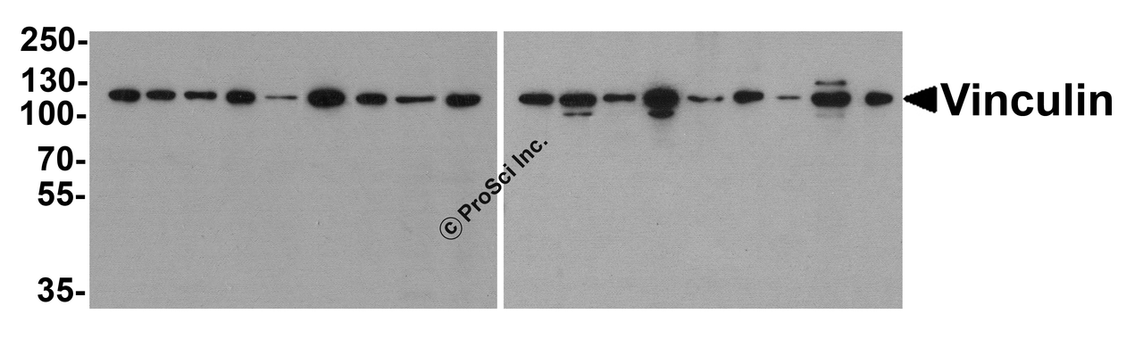 Western blot analysis of Vinculin in 293, A431, A549, HeLa, HepG2, K562, 3T3, Raji, U937 cell lysate and rat heart, mouse lung, rat lung, mouse spleen, rat spleen, rabbit spleen, mouse brain, rabbit brain and chicken spleen tissue lysate with Vinculin antibody at 1 &#956;g/ml.