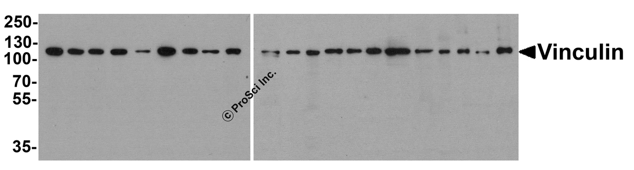 Western blot analysis of Vinculin in 293, A431, A549, HeLa, HepG2, K562, 3T3, Raji, U937 cell lysate and human kidney, human breast, mouse brain, mouse lung, mouse spleen, rat heart, rat lung, rat spleen, rat liver, rabbit spleen, rabbit brain and chicken spleen tissue lysate with Vinculin antibody at 1 &#956;g/ml.
