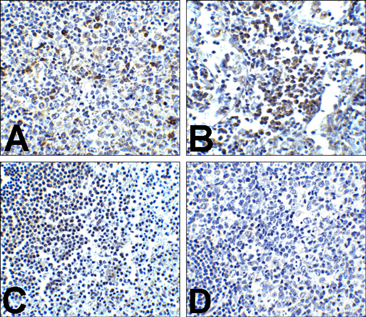 Immunohistochemistry of PD-1 in (A) human tonsil tissue, (B) human lymph node tissue, and (C) human spleen tissue with PD-1 antibody at 5 ug/mL. (D) Immunohistochemistry in human tonsil tissue with control mouse IgG staining at 5 ug/mL.