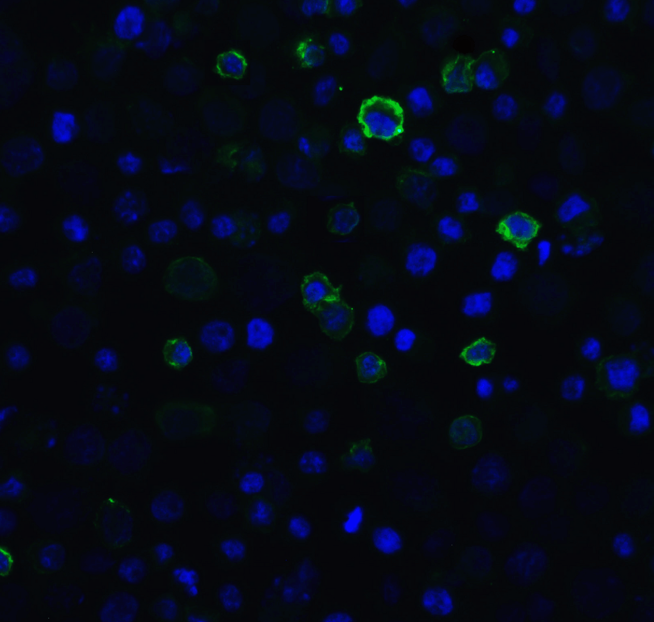 Immunofluorescence of PD-1 in in overexpressing HEK293 cells with PD-1 antibody at 20 ug/mL. <br><br>Green: PD1 Antibody [5D3] (RF16006) <br> Blue: DAPI staining