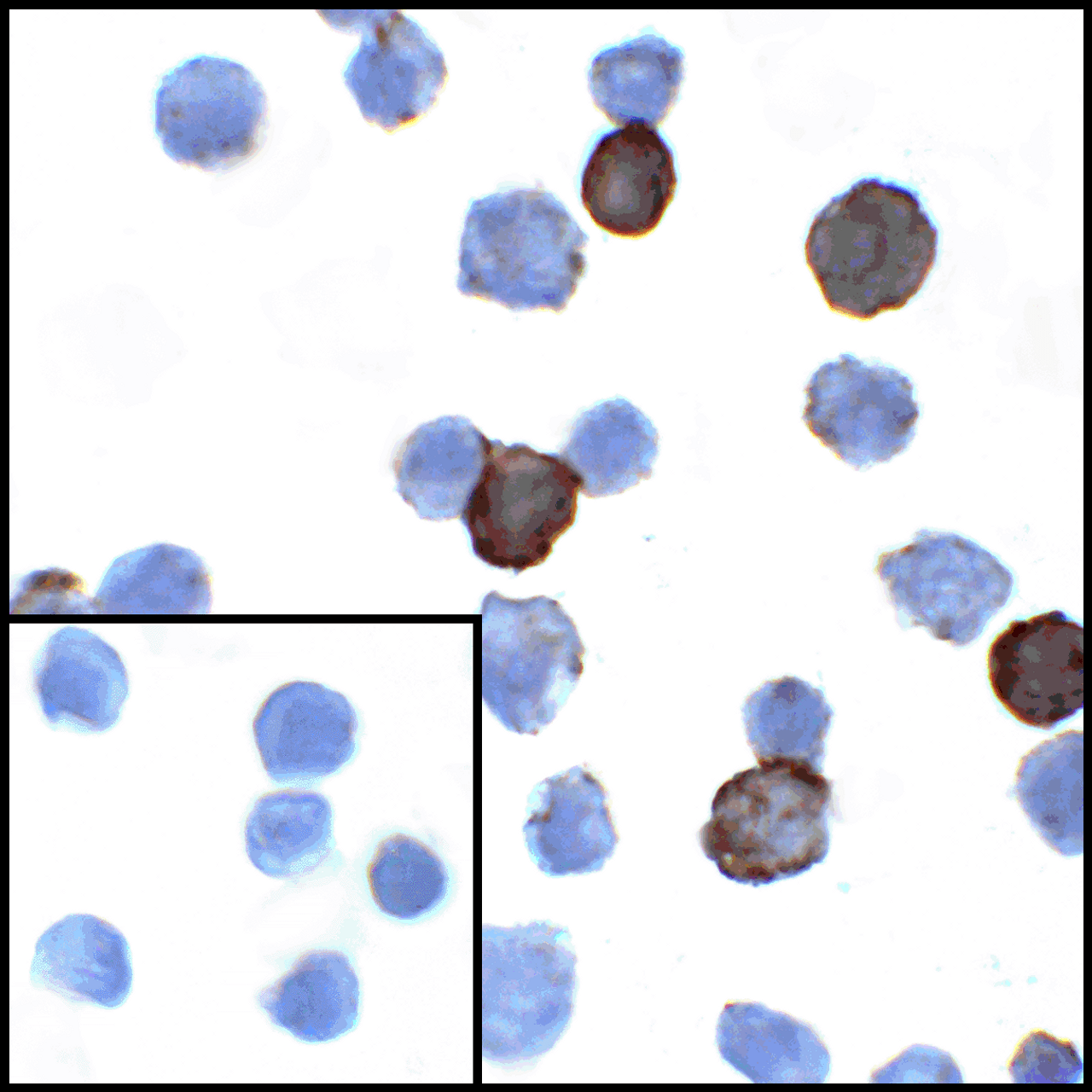 Immunocytochemistry of PD-L1 in transfected HEK293 cells with PD-L1 antibody at 1 ug/mL. Lower left: Immunocytochemistry in transfected HEK293 cells with control mouse IgG antibody at 1 ug/mL.