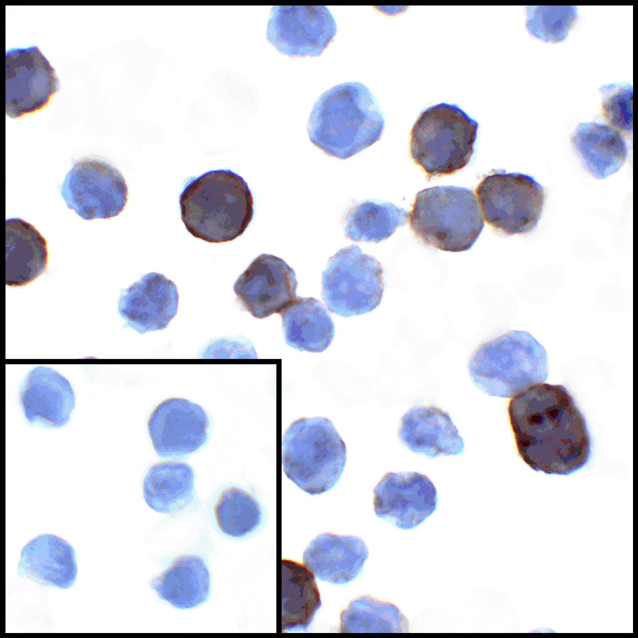 Immunocytochemistry of PD-L1 in transfected HEK293 cells with PD-L1 antibody at 1 ug/mL. Lower left: Immunocytochemistry in transfected HEK293 cells with control mouse IgG antibody at 1 ug/mL.