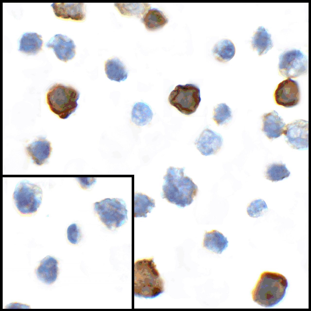 Immunocytochemistry of CD80 in transfected HEK293 cells with CD80 antibody at 1 ug/mL. Lower left: Immunocytochemistry in transfected HEK293 cells with control mouse IgG antibody at 1 ug/mL.