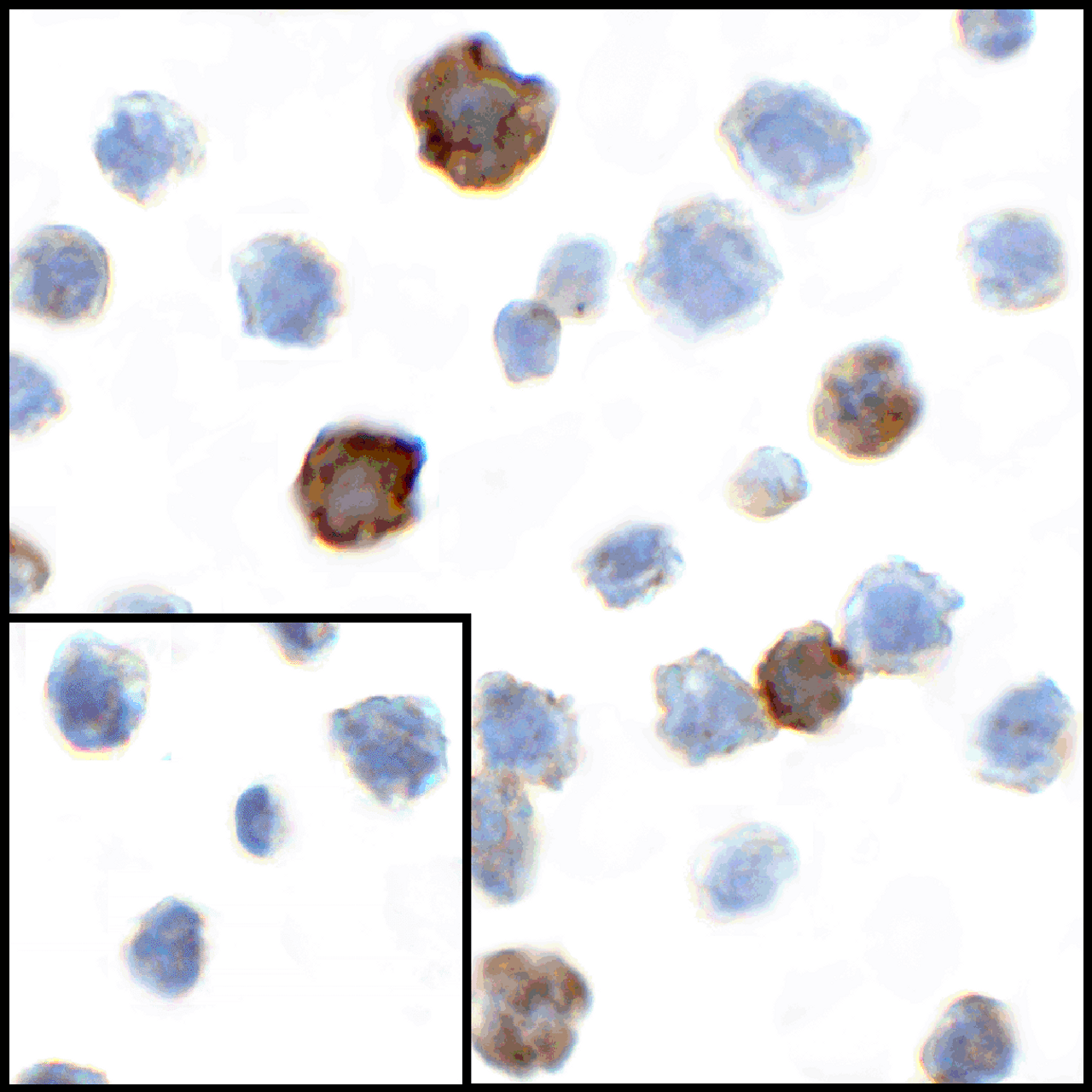 Immunocytochemistry of CD80 in transfected HEK293 cells with CD80 antibody at 1 ug/mL. Lower left: Immunocytochemistry in transfected HEK293 cells with control mouse IgG antibody at 1 ug/mL.