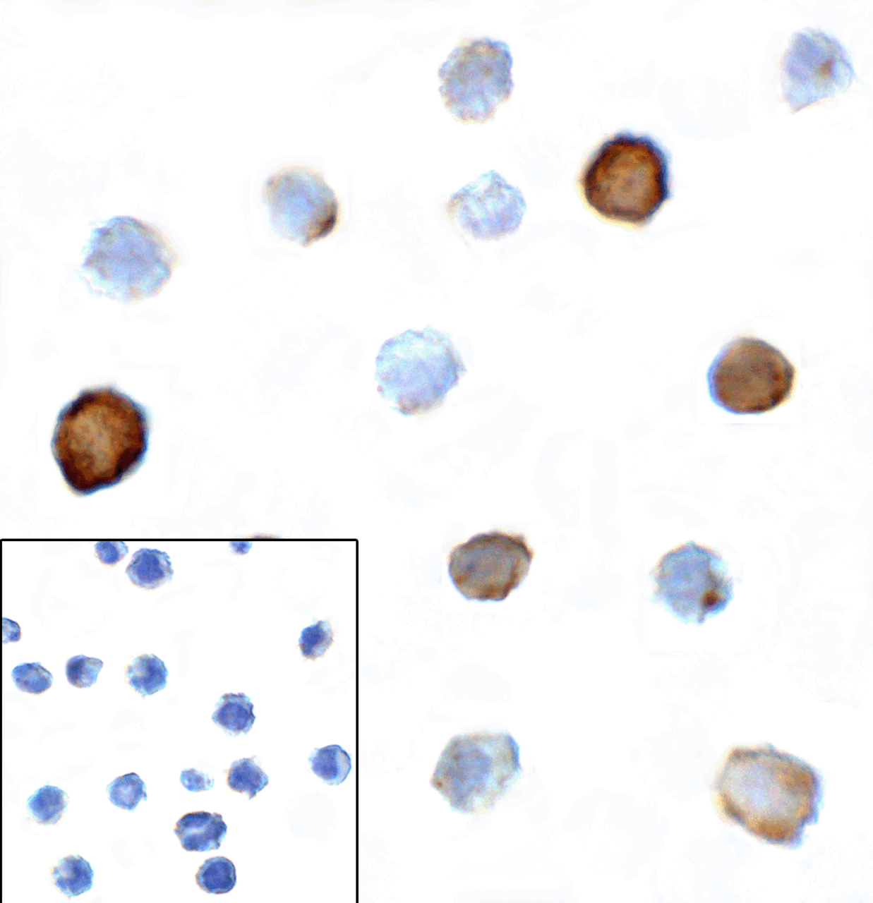 Immunocytochemistry of TIGIT in over expressing HEK293 cells using TIGIT antibody and control mouse IgG antibody (left corner box) at 1 ug/ml.