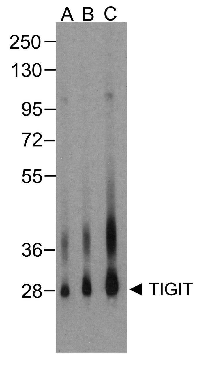 Western blot analysis of TIGIT in over expressing HEK293 cells using RF16056 antibody at (A) 0.25 &#956;g/ml, (B) 0.5 &#956;g/ml, and (C) 1 &#956;g/ml.