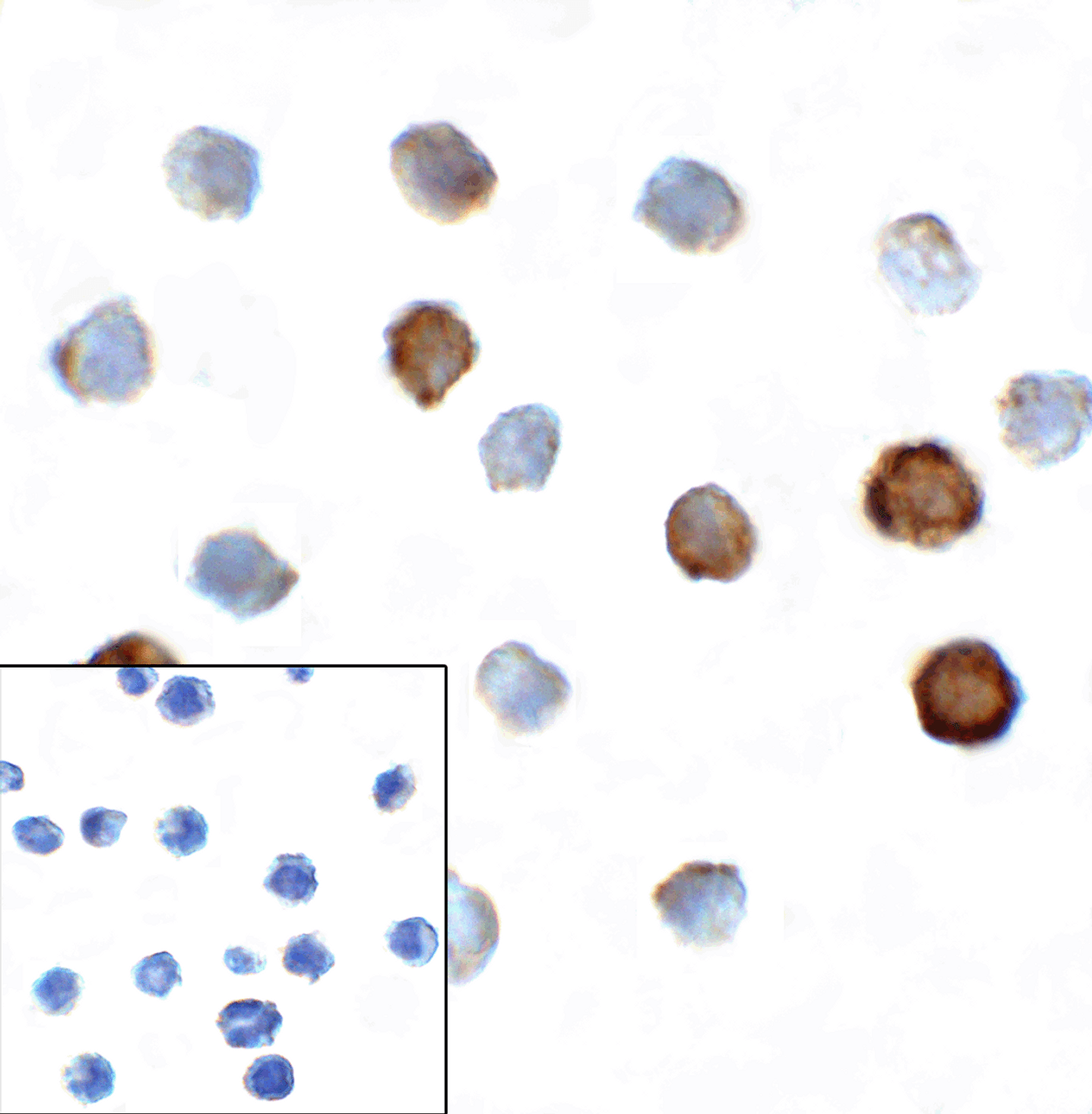 Immunocytochemistry of TIGIT in over expressing HEK293 cells using TIGIT antibody and control mouse IgG antibody (left corner box) at 1 ug/ml.