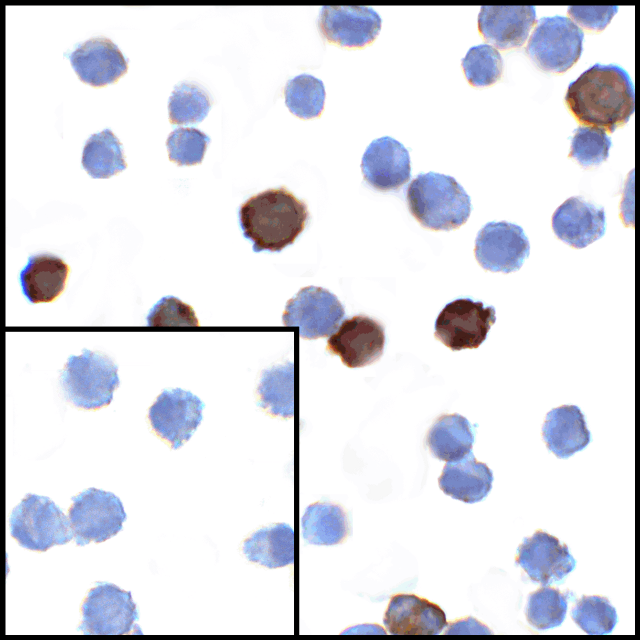 Immunocytochemistry of LIGHT in transfected HEK293 cells with LIGHT antibody at 1 ug/mL. Lower left: Immunocytochemistry in transfected HEK293 cells with control mouse IgG antibody at 1 ug/mL.