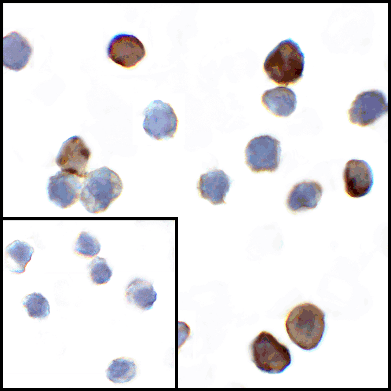Immunocytochemistry of VISTA in transfected HEK293 cells with VISTA antibody at 1 ug/mL. Lower left: Immunocytochemistry in transfected HEK293 cells with control mouse IgG antibody at 1 ug/mL.