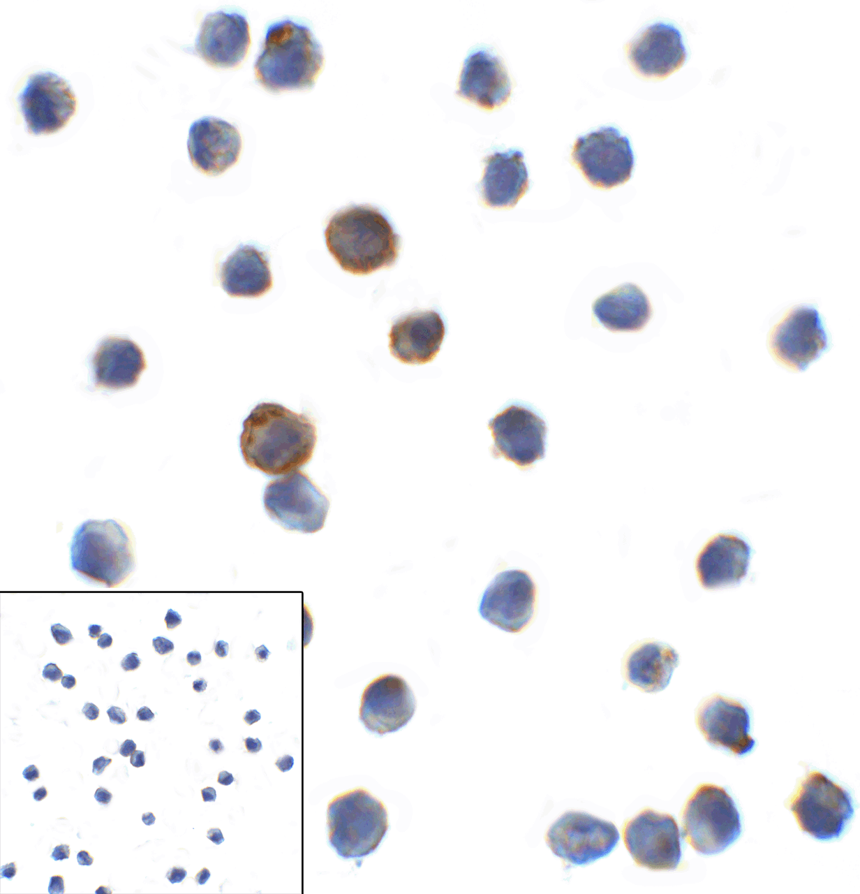 Immunocytochemistry of LAG-3 in over expressing HEK293 cells using LAG-3 antibody and control mouse IgG antibody (left corner box) at 1 ug/ml.
