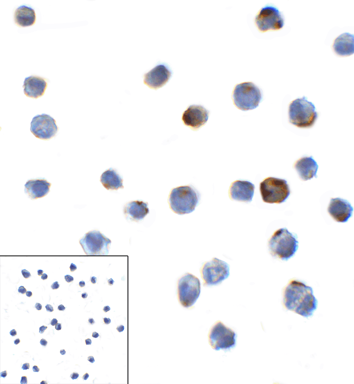 Immunocytochemistry of LAG-3 in over expressing HEK293 cells using LAG-3 antibody and control mouse IgG antibody (left corner box) at 1 ug/ml.