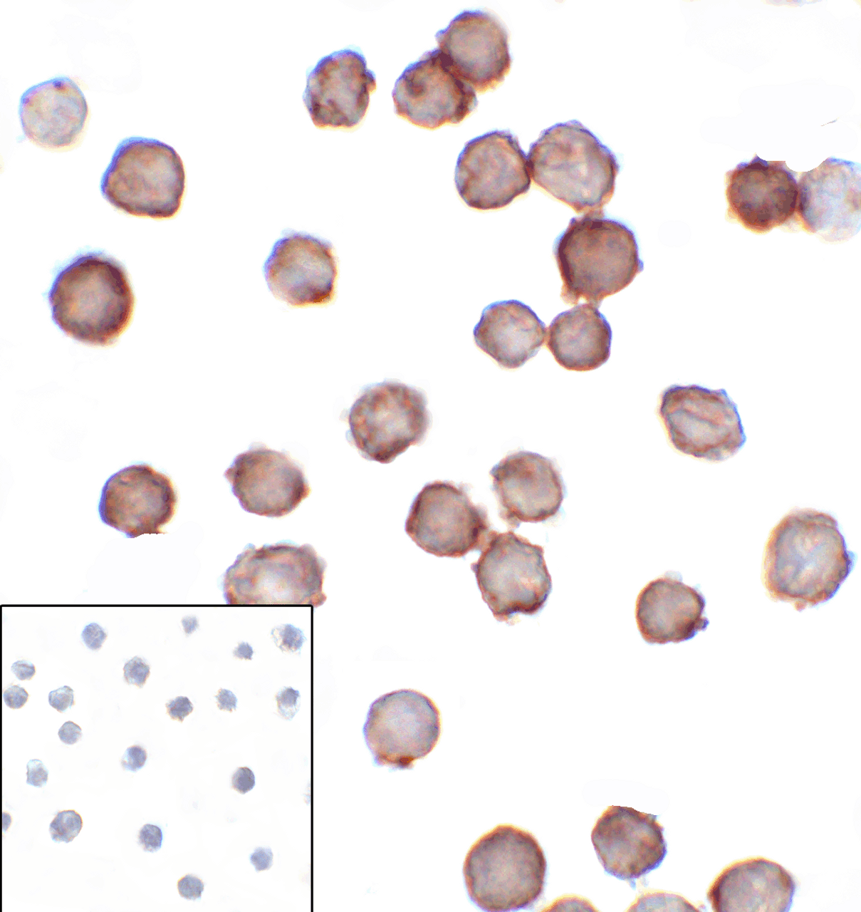 Immunocytochemistry of B7-H3 in HEK293 cells using B7-H3 antibody and control mouse IgG antibody (left corner box) at 1 ug/ml.