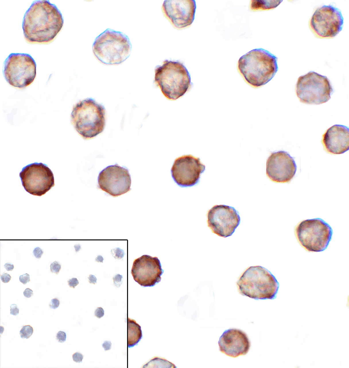 Immunocytochemistry of B7-H3 in HEK293 cells using B7-H3 antibody and control mouse IgG antibody (left corner box) at 1 ug/ml.