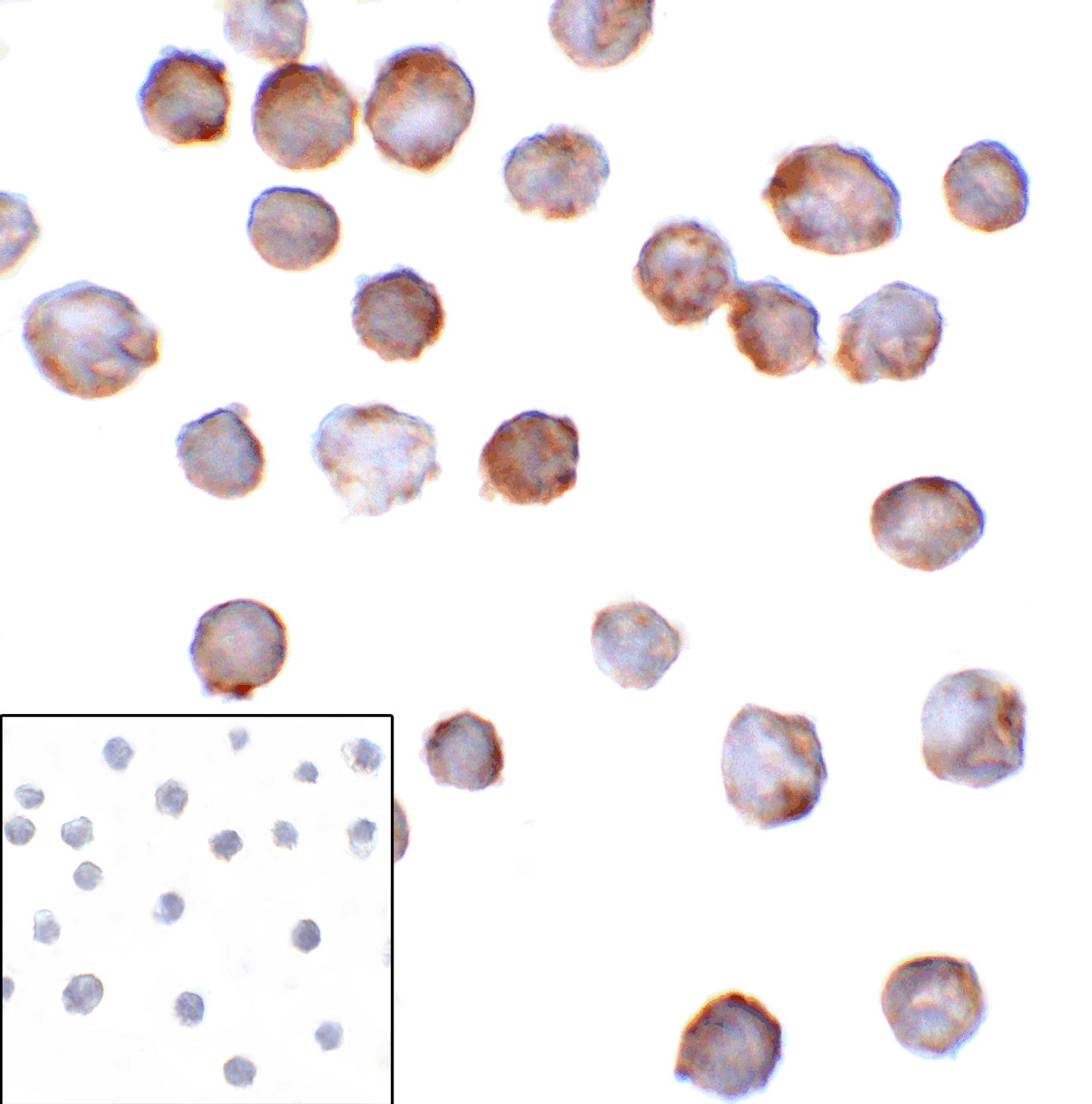 Immunocytochemistry of B7-H3 in HEK293 cells using B7-H3 antibody and control mouse IgG antibody (left corner box) at 1 ug/ml.