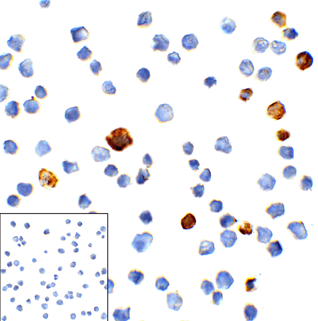 Immunocytochemistry of TIM-3 in transfected HEK293 cells with TIM-3 antibody at 1 ug/mL. Lower left: Immunocytochemistry in transfected HEK293 cells with control mouse IgG antibody at 1 ug/mL.