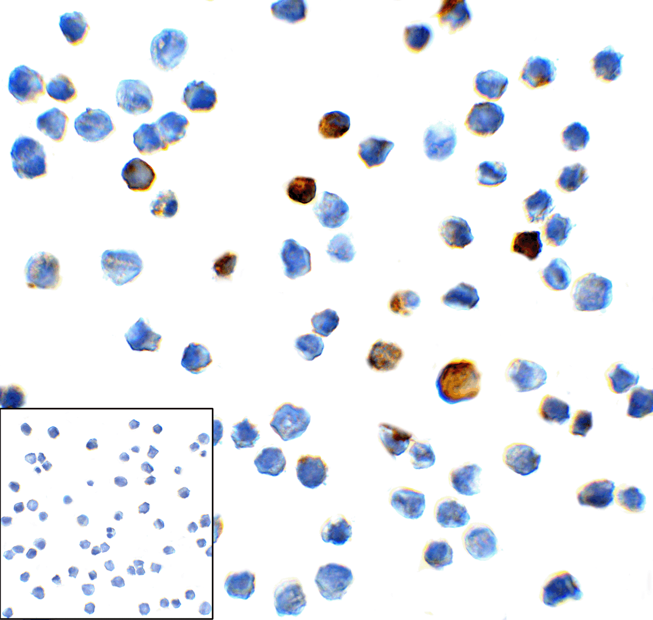 Immunocytochemistry of TIM-3 in transfected HEK293 cells with TIM-3 antibody at 1 ug/mL. Lower left: Immunocytochemistry in transfected HEK293 cells with control mouse IgG antibody at 1 ug/mL.