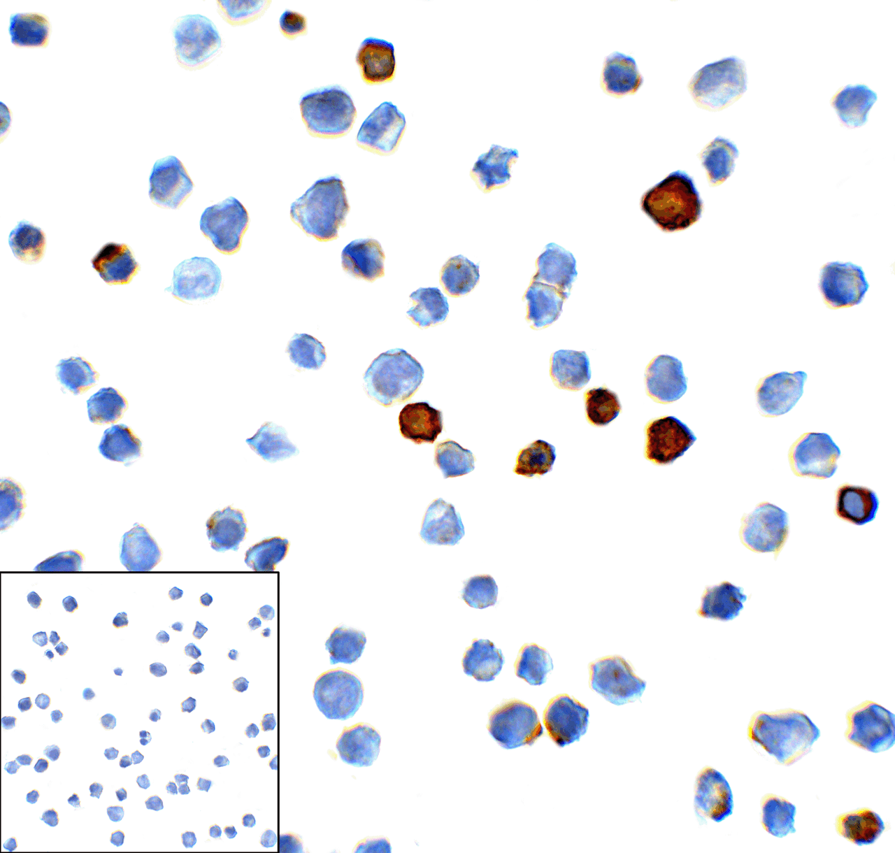 Immunocytochemistry of TIM-3 in transfected HEK293 cells with TIM-3 antibody at 1 ug/mL. Lower left: Immunocytochemistry in transfected HEK293 cells with control mouse IgG antibody at 1 ug/mL.