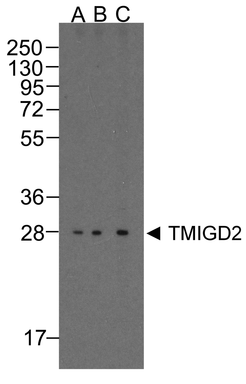 Western blot analysis of TMIGD2 in overexpressing HEK293 cells TMIGD2 antibody at 0.25, 0.5, and 1 &#956;g/ml