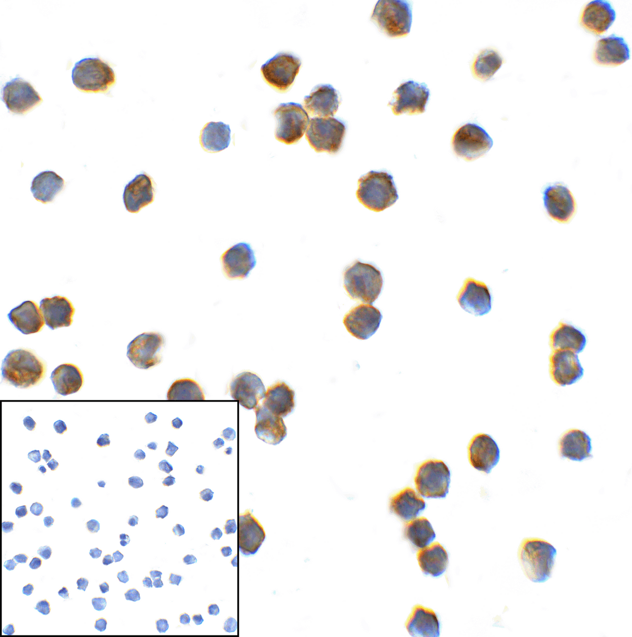 Immunocytochemistry of TMIGD2 in transfected HEK293 cells with TMIGD2 antibody at 2 ug/mL. Lower left: Immunocytochemistry in transfected HEK293 cells with control mouse IgG antibody at 2 ug/mL.