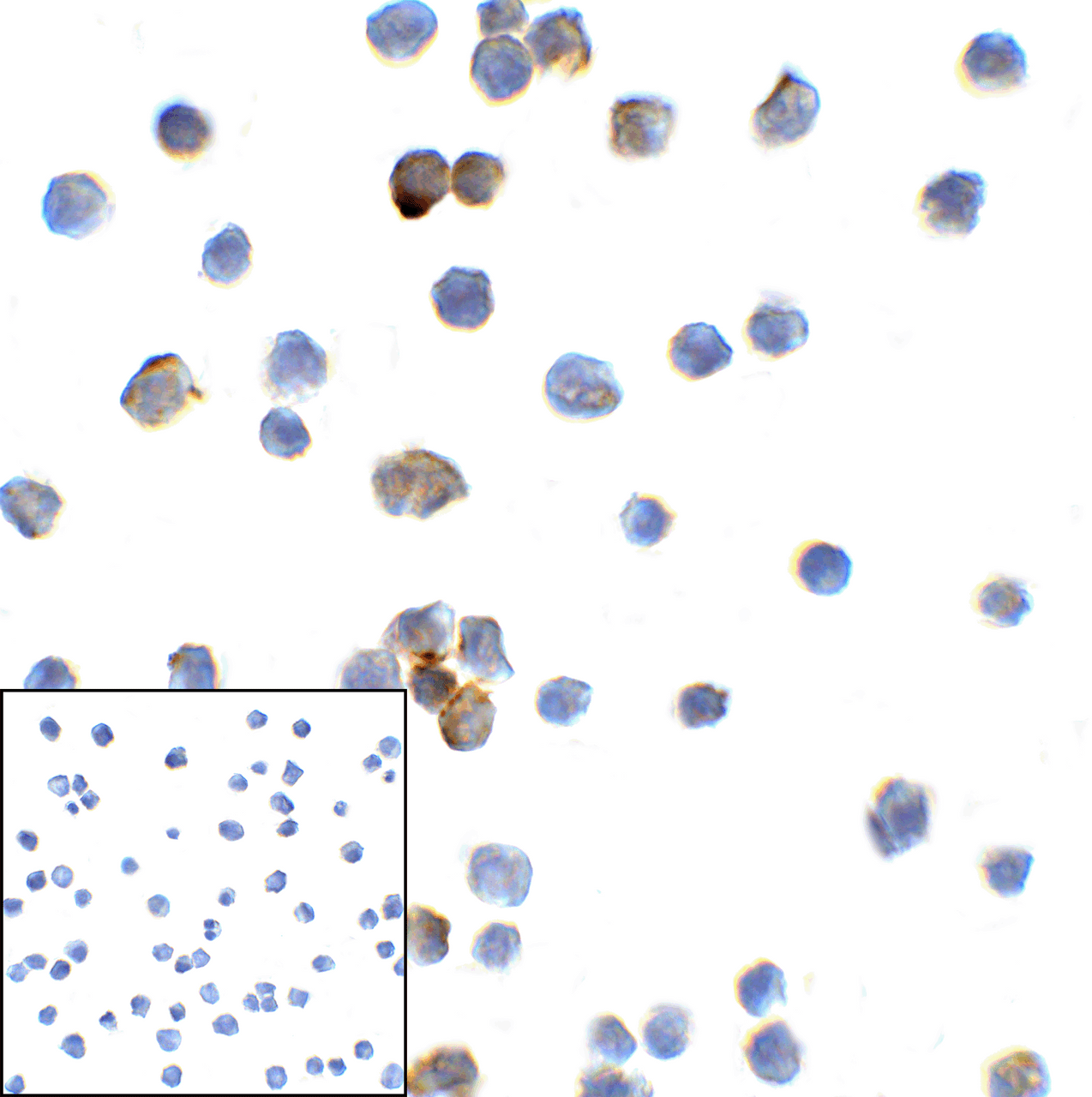 Immunocytochemistry of TMIGD2 in transfected HEK293 cells with TMIGD2 antibody at 2 ug/mL. Lower left: Immunocytochemistry in transfected HEK293 cells with control mouse IgG antibody at 2 ug/mL.