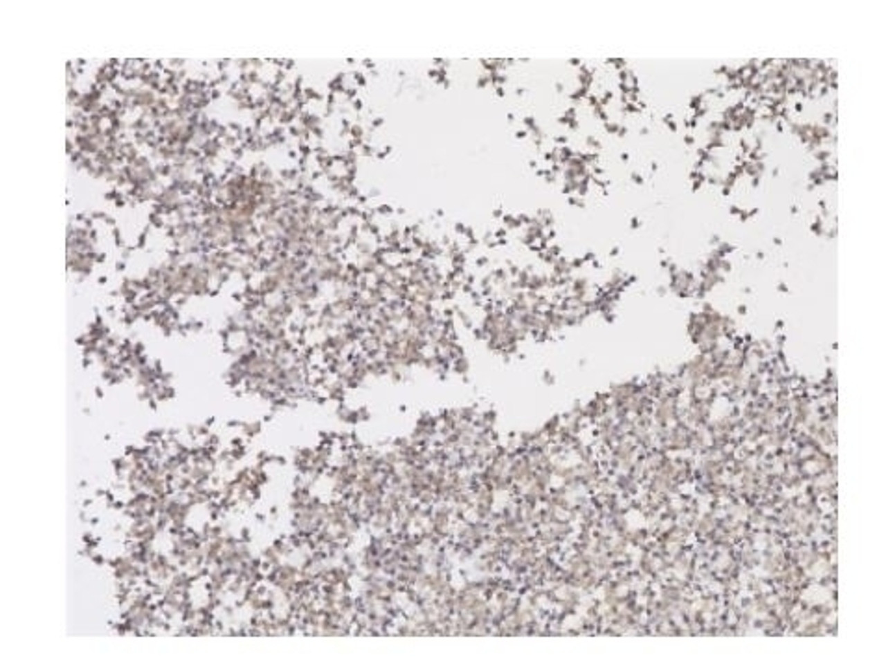 SARS-CoV-2 Spike RBD Antibody (clone 2165) IHC Data using infected cell pellets.