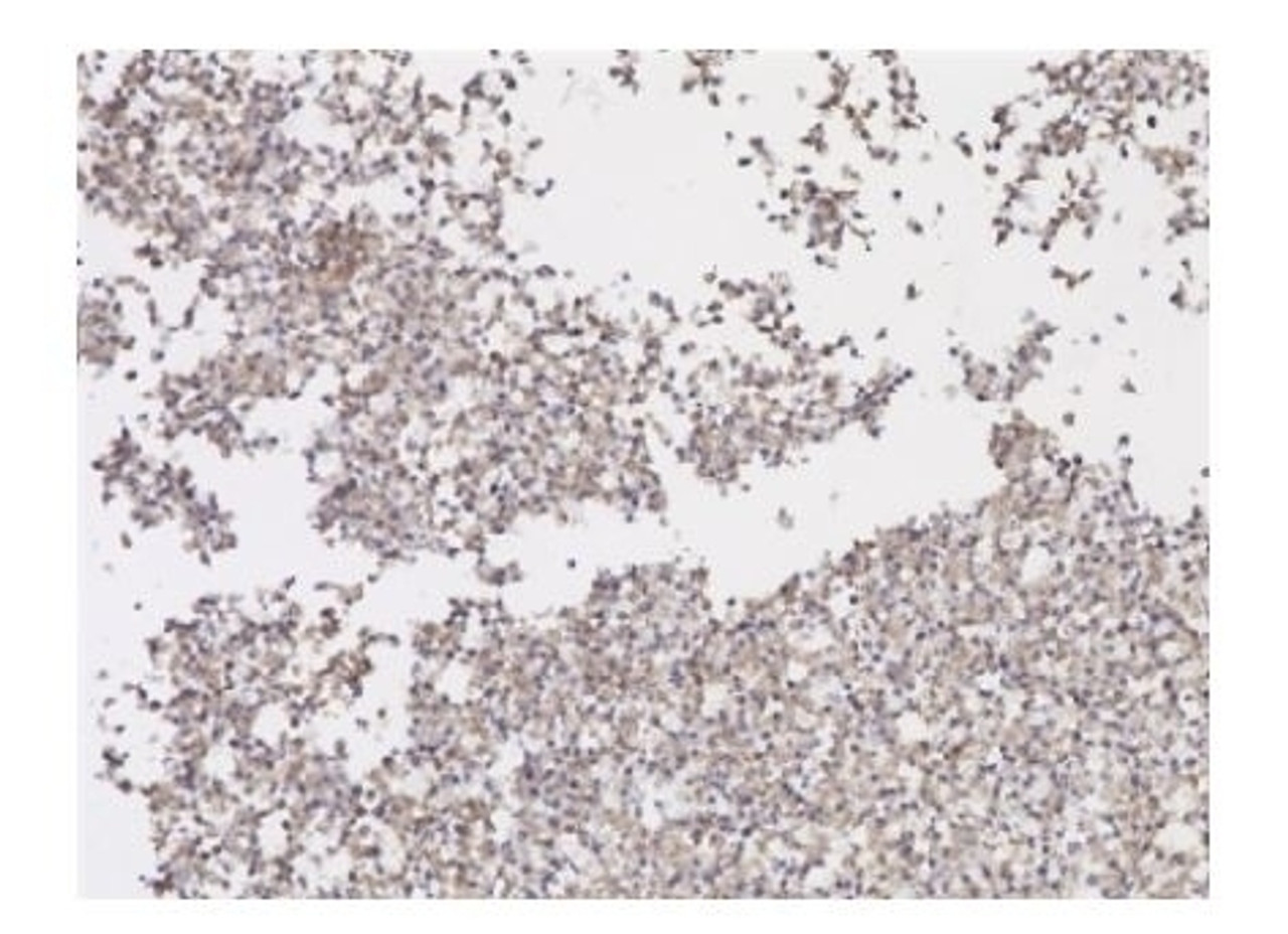 SARS-CoV-2 Spike RBD Antibody (clone 2165) IHC Data using infected cell pellets.