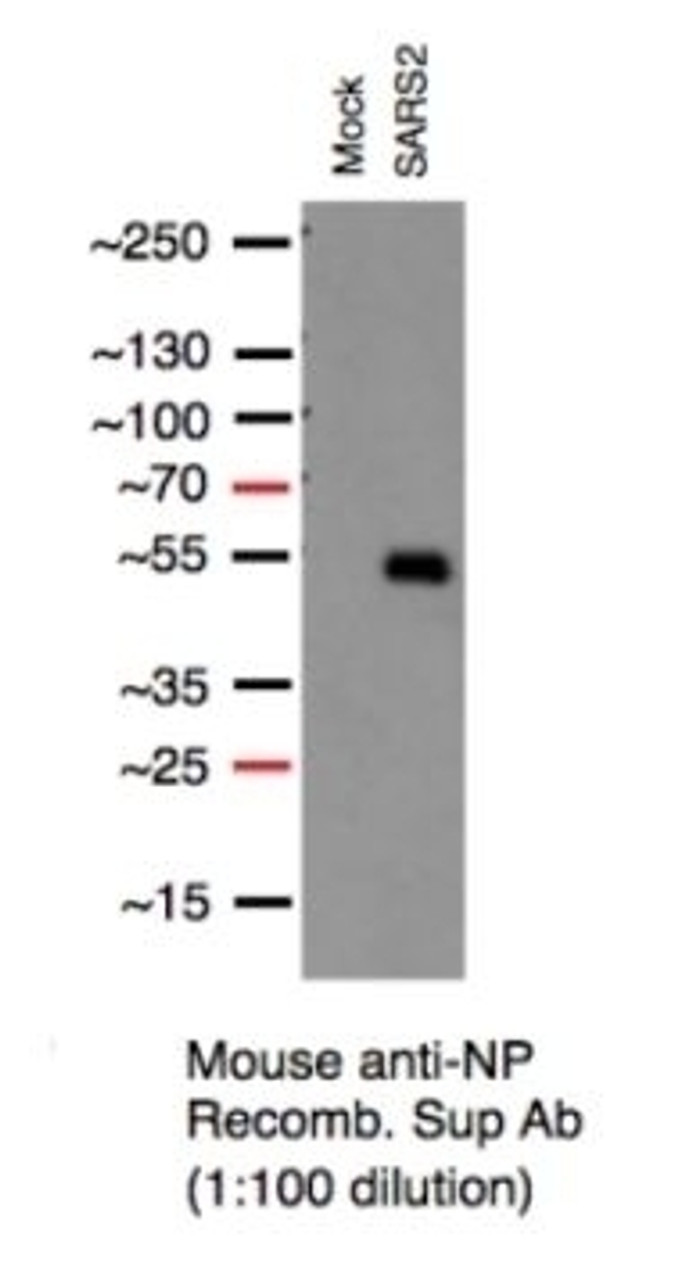 Lysates were derived from A549 cells (Transduced with ACE2 by adenoviral vector) , mock vs. SARS-CoV-2-infected MO12, 24 hours, with 60ug of lysates loaded/lane, Image Courtesy of Jeff Johnson Laboratory, ISMMS.