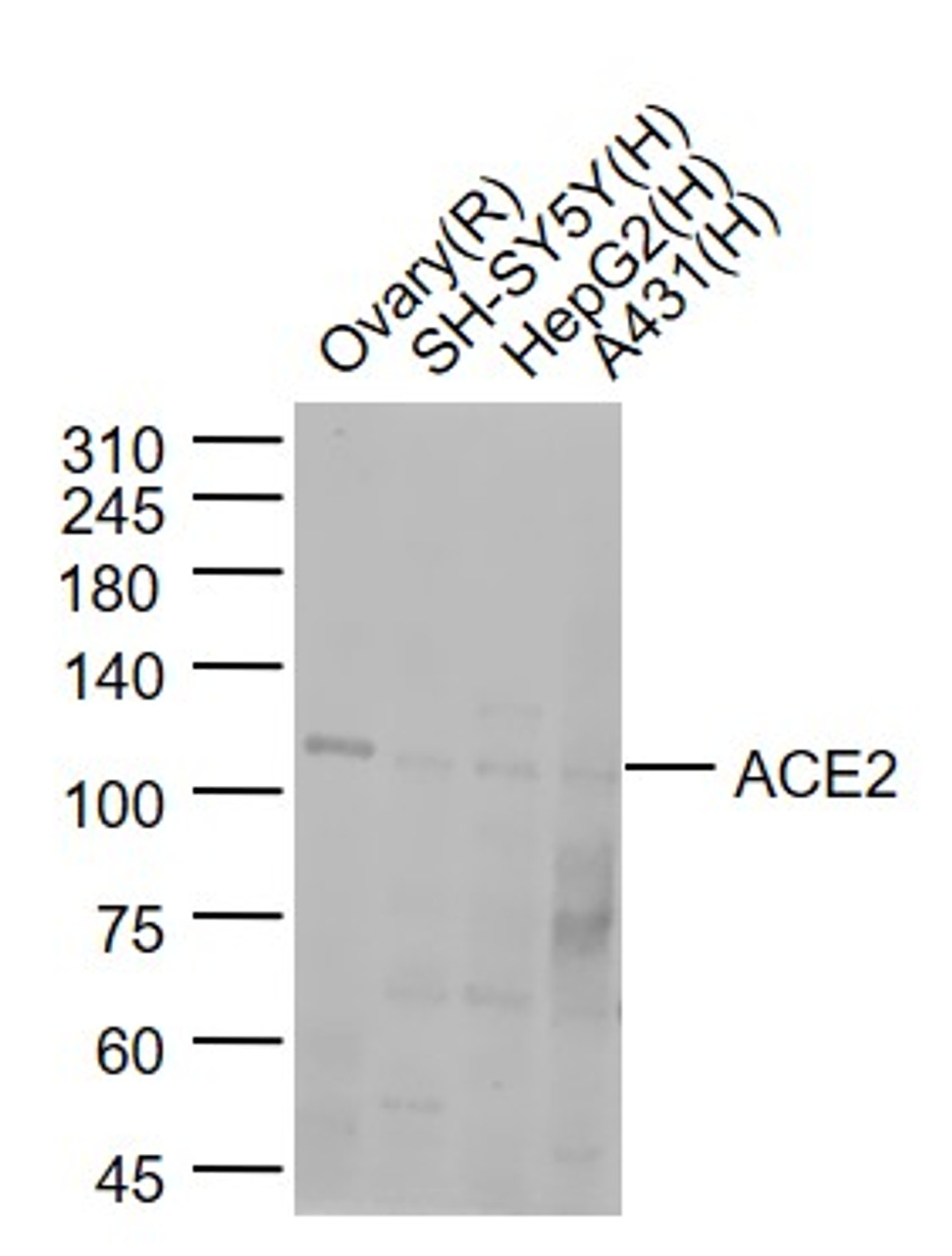 <strong>Figure 1 Western Blot Validation of ACE2</strong><br>
Lane 1: rat ovary lysates, Lane 2: SH-SY5Y cell lysates, Lane 3: HepG2 cell lysates, Lane 4: A431 cell lysates probed with ACE2 antibody, 10-600, at 1:1000 dilution and 4˚C overnight incubation. Followed by conjugated secondary antibody incubation at 1:20000 for 60 min at 37˚C.