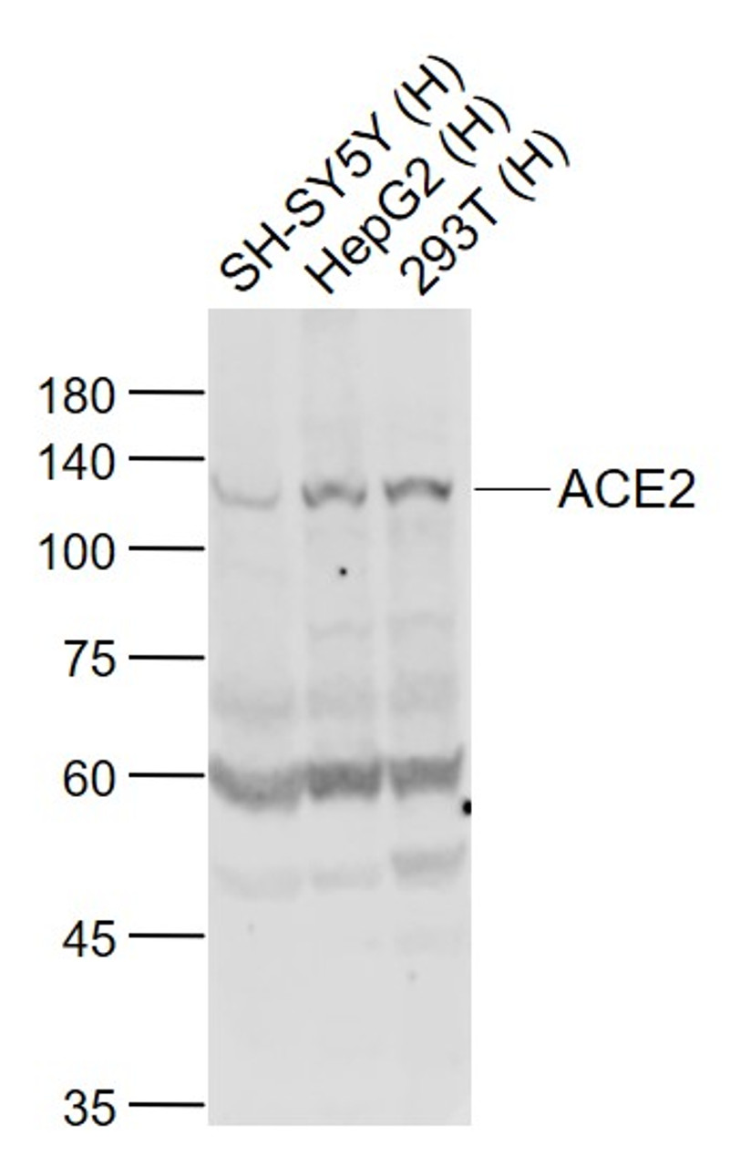 <strong>Figure 1 Western Blot Validation of ACE2</strong><br>
Lane 1: SH-SY5Y cell lysates, Lane 2: HepG2 cell lysates and Lane 3: 293T cell lysates probed with ACE2 antibody, 10-602, at 1:1000 dilution and 4˚C overnight incubation. Followed by conjugated secondary antibody incubation at 1:20000 for 60 min at 37˚C.