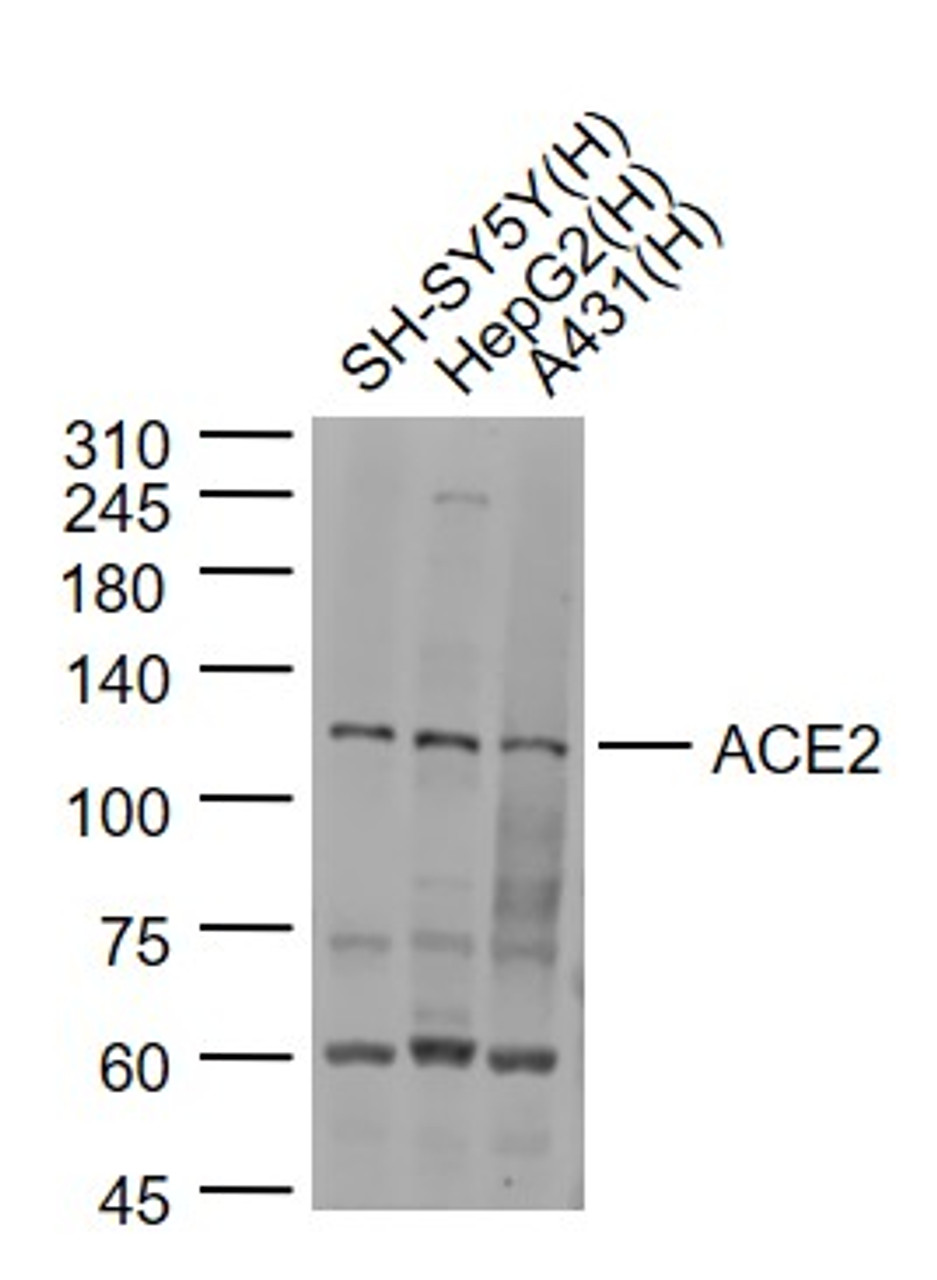 <strong>Figure 2 Western Blot Validation of ACE2</strong><br>
Lane 1: SH-SY5Y cell lysates, Lane 2: HepG2 cell lysates and Lane 3: A431 cell lysates probed with ACE2 antibody, 10-602, at 1:1000 dilution and 4˚C overnight incubation. Followed by conjugated secondary antibody incubation at 1:20000 for 60 min at 37˚C.