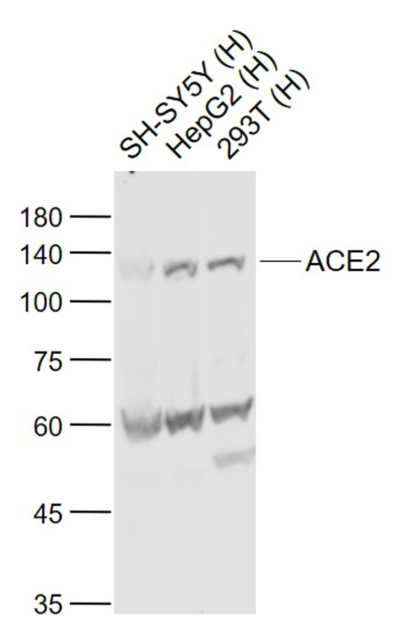 <strong>Figure 1 Western Blot Validation of ACE2</strong><br>
Lane 1: SH-SY5Y cell lysates, Lane 2: HepG2 cell lysates and Lane 3: 293T cell lysates probed with ACE2 antibody, 10-603, at 1:1000 dilution and 4˚C overnight incubation. Followed by conjugated secondary antibody incubation at 1:20000 for 60 min at 37˚C.