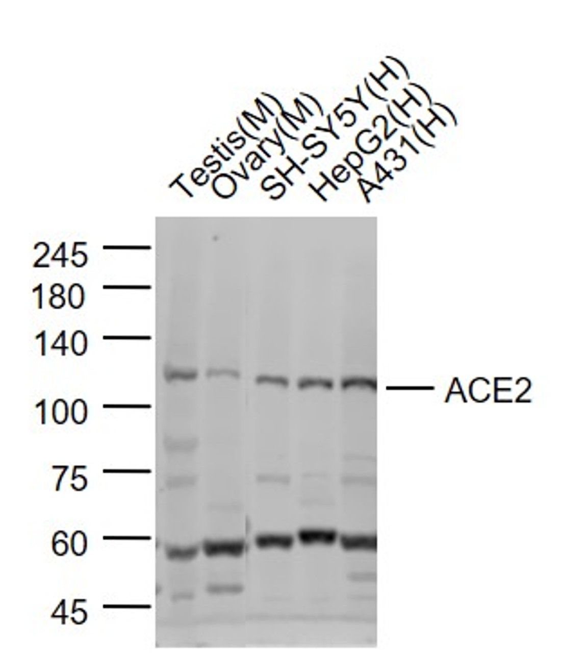 <strong>Figure 2 Western Blot Validation of ACE2</strong><br>
Lane 1: mouse testis lysates, Lane 2: mouse ovary lysates, Lane 3: SH-SY5Y cell lysates, Lane 4: HepG2 cell lysates and Lane 5: A431 cell lysates probed with ACE2 antibody, 10-603, at 1:1000 dilution and 4˚C overnight incubation. Followed by conjugated secondary antibody incubation at 1:20000 for 60 min at 37˚C.