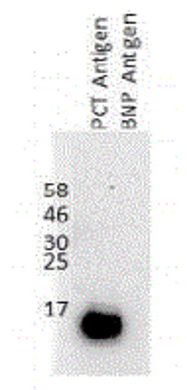 Antibody: 54-300 at 1/1000 dilution<br>Sample: 30 ng recombinant procalcitonin<br>Secondary: HRP conjuggated anti-Rabbit Fc at 1/50000 dilution<br>Predicted band size: 17 kDa<br>Observed band size: 17 kDa<br>Gel concentration: 4-20%