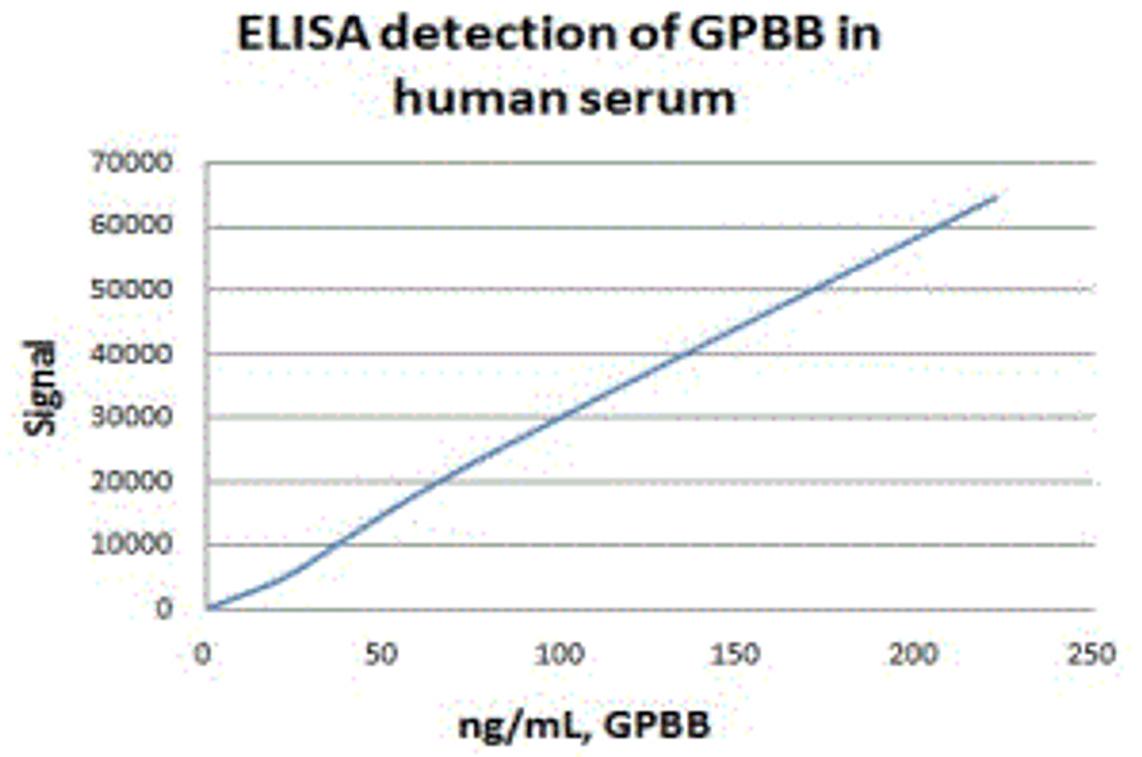 GPBB Antibody [E9B10] | 54-306
