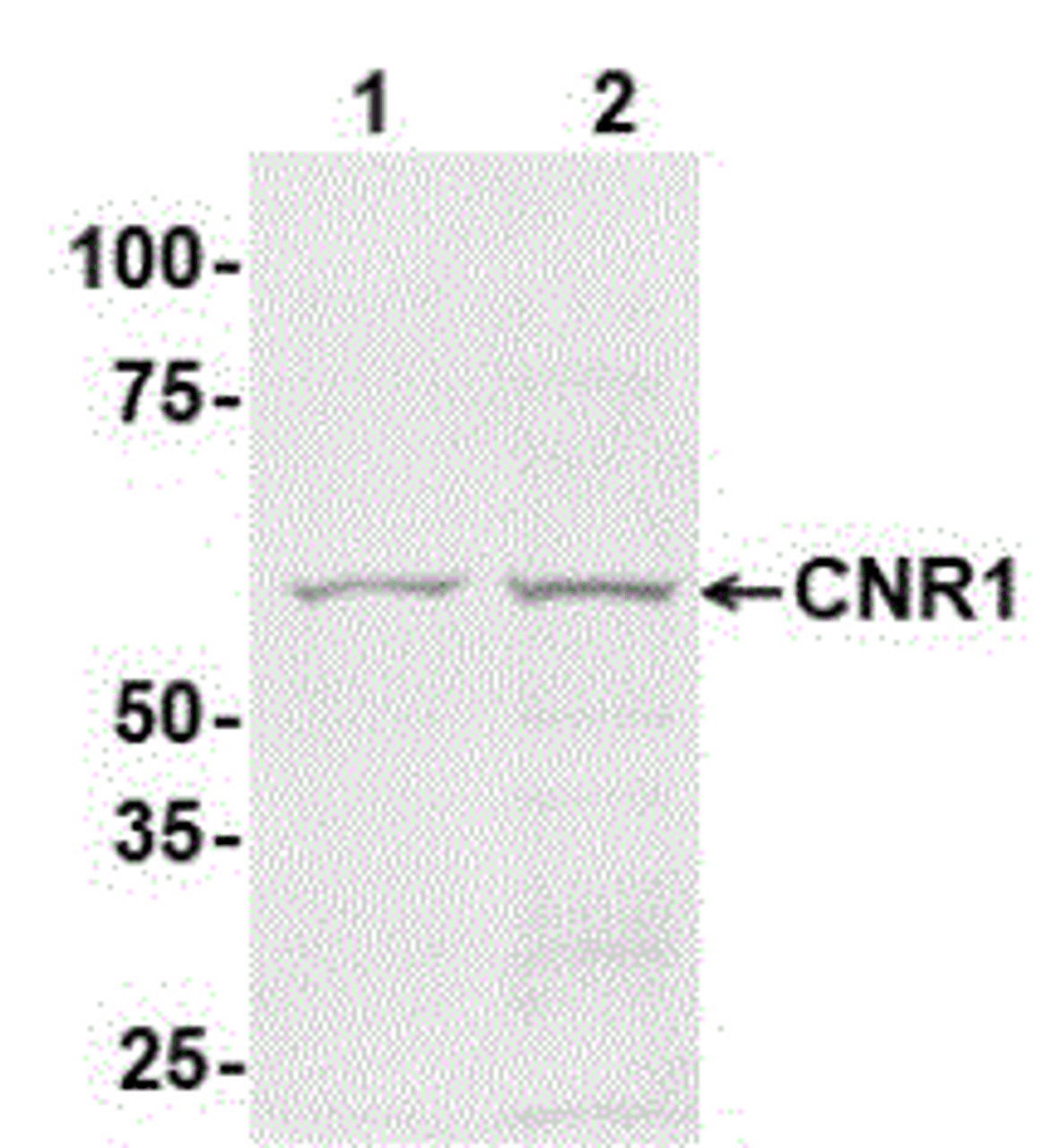 Antibody: 54-332 at 1/1000 dilution<br>Sample: Lane: 1 10 ug mouse brain tissue lysate. Lane: 2 25 ug mouse brain tissue lysate<br>Secondary: HRP-conjugated anti-rabbit IgG at 1/50000 dilution<br>Predicted band size: 60 kDa<br>Observed band size: 60 kDa<br>Gel concentration: 4-20%