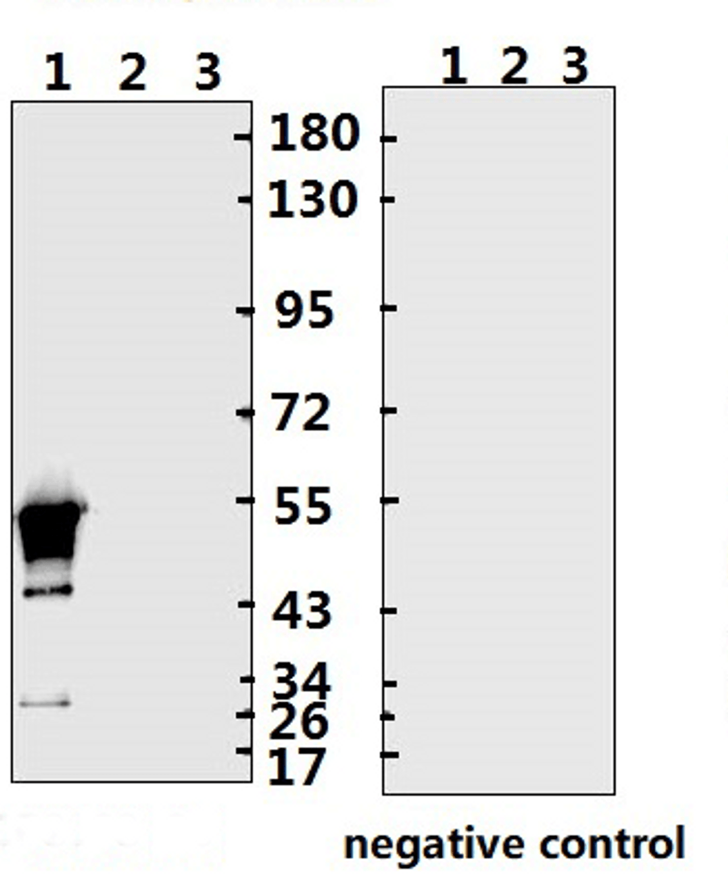 <strong>Figure 1 Western Blot Validation with Recombinant Protein</strong><br>Loading: 1ug of recombinant protein per lane. Lane 1: 10-007, Lane 2: 10-008 and Lane 3: 10-011. Antibodies: SARS-CoV-2 (COVID-19) Nucleocapsid, 10-508, 1:500. Secondary: Goat anti-rabbit IgG HRP conjugate at 1:20000 dilution.