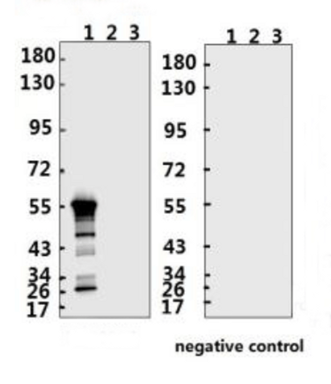 <strong>Figure 1 Western Blot Validation with Recombinant Protein</strong><br>Loading: 1ug of recombinant protein per lane. Lane 1: 10-007, Lane 2: 10-008 and Lane 3: 10-011. Antibodies: SARS-CoV-2 (COVID-19) Nucleocapsid, 10-509, 1:500. Secondary: Goat anti-rabbit IgG HRP conjugate at 1:20000 dilution.