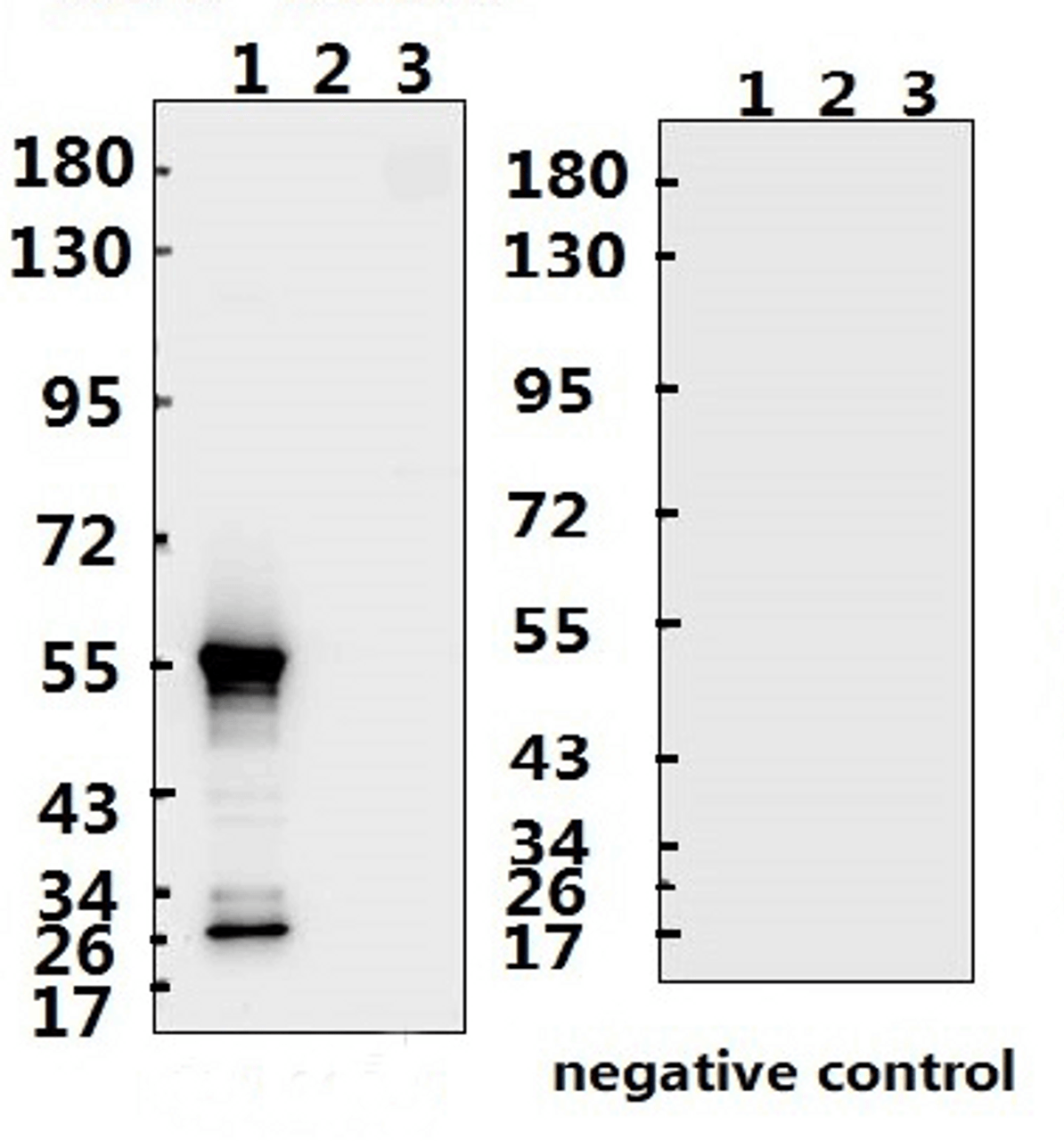 <strong>Figure 1 Western Blot Validation with Recombinant Protein</strong><br>Loading: 1ug of recombinant protein per lane. Lane 1: 10-007, Lane 2: 10-008 and Lane 3: 10-011. Antibodies: SARS-CoV-2 (COVID-19) Nucleocapsid, 10-510, 1:500. Secondary: Goat anti-rabbit IgG HRP conjugate at 1:20000 dilution.
