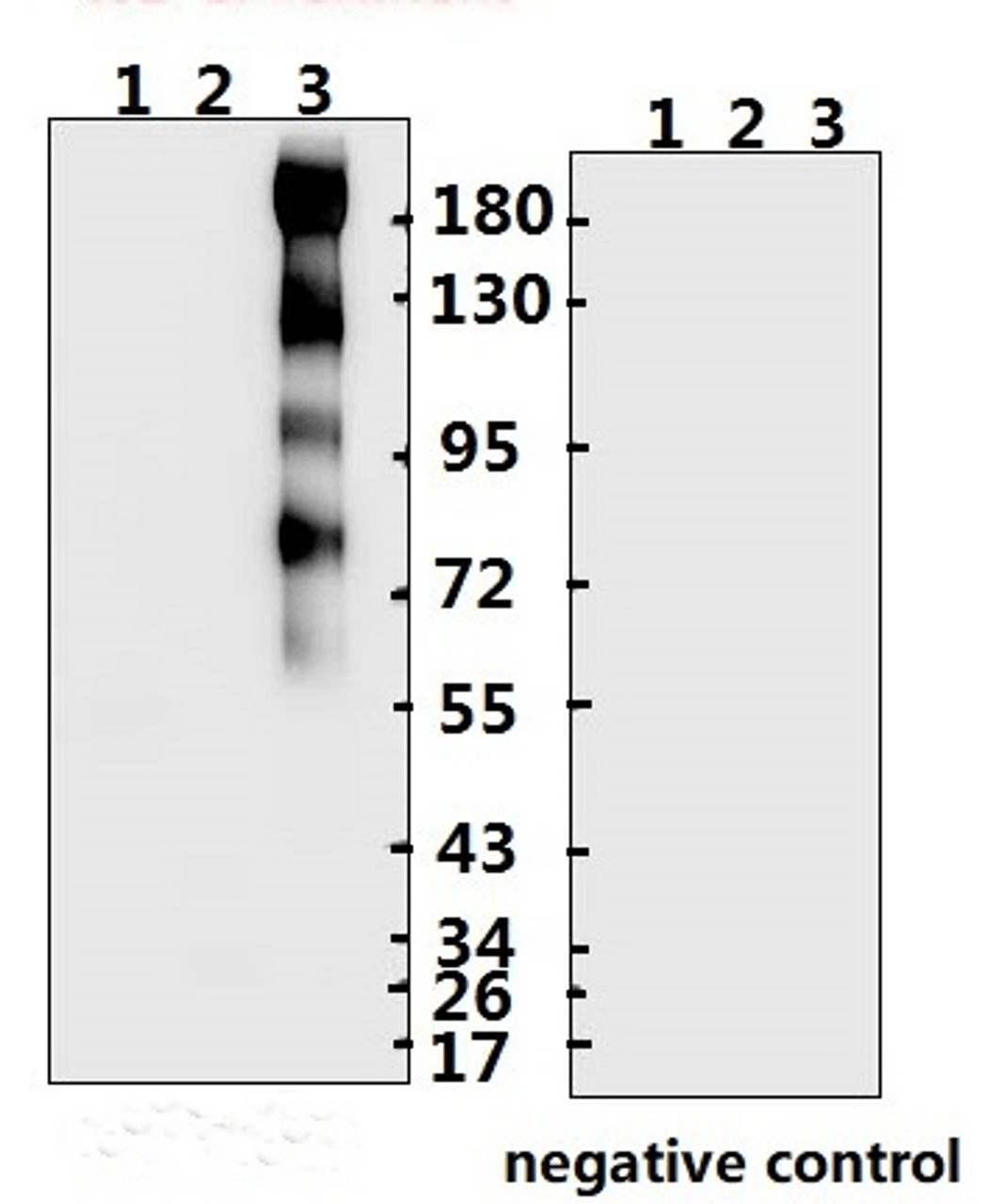 <strong>Figure 1 Western Blot Validation with Recombinant Protein</strong><br>Loading: 1ug of recombinant protein per lane. Lane 1: 10-007, Lane 2: 10-008 and Lane 3: 10-011. Antibodies: SARS-CoV-2 (COVID-19) Spike S2, 10-526, 1:500. Secondary: Goat anti-rabbit IgG HRP conjugate at 1:20000 dilution.